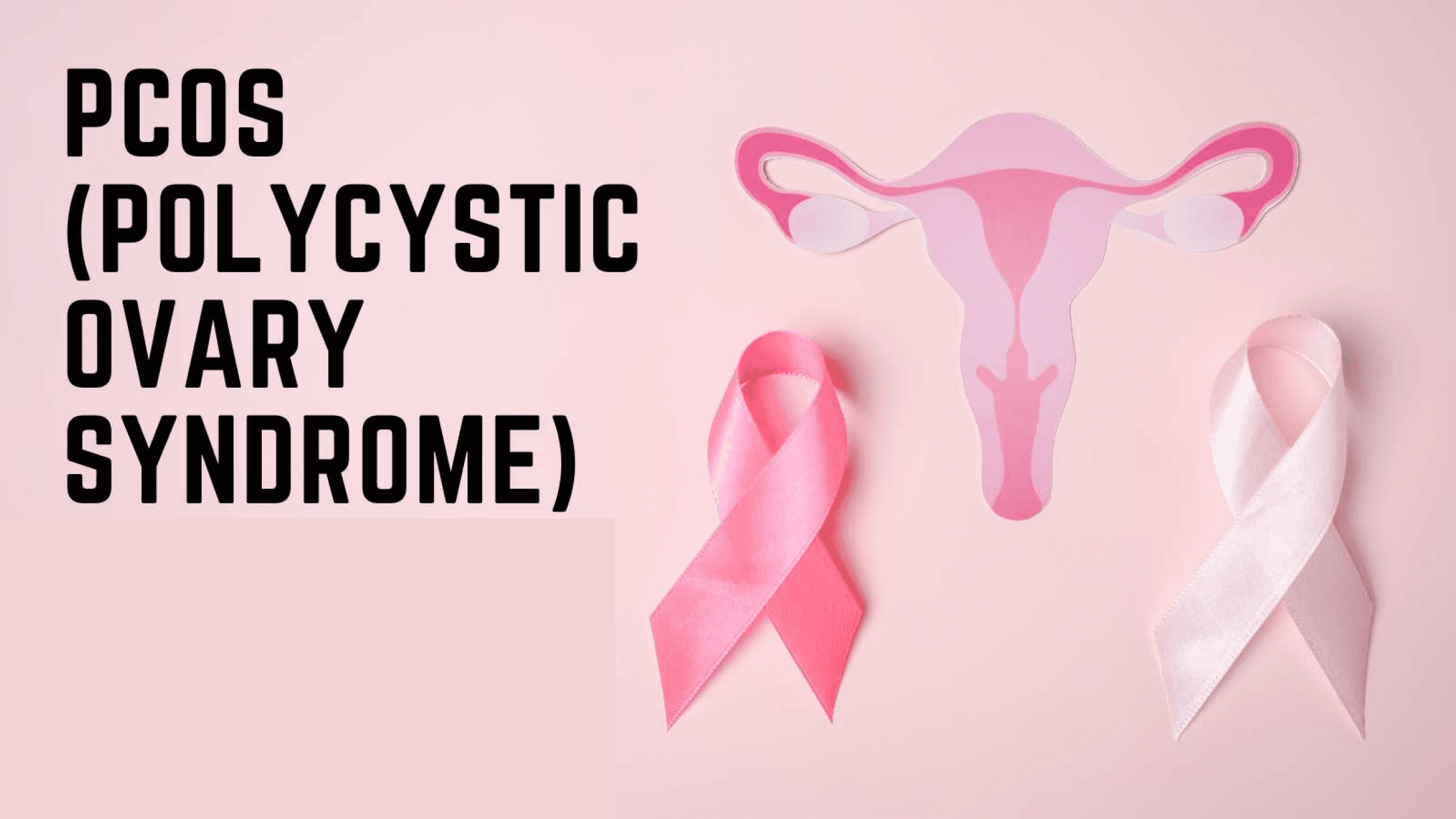 POLYCYSTIC OVARIAN SYNDROME AND HOMOEOPATHY